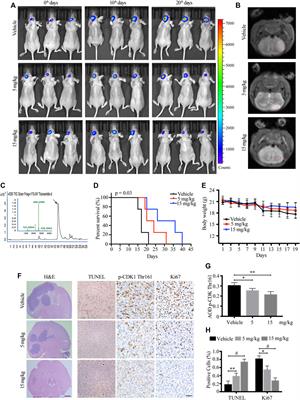 Tizoxanide Promotes Apoptosis in Glioblastoma by Inhibiting CDK1 Activity